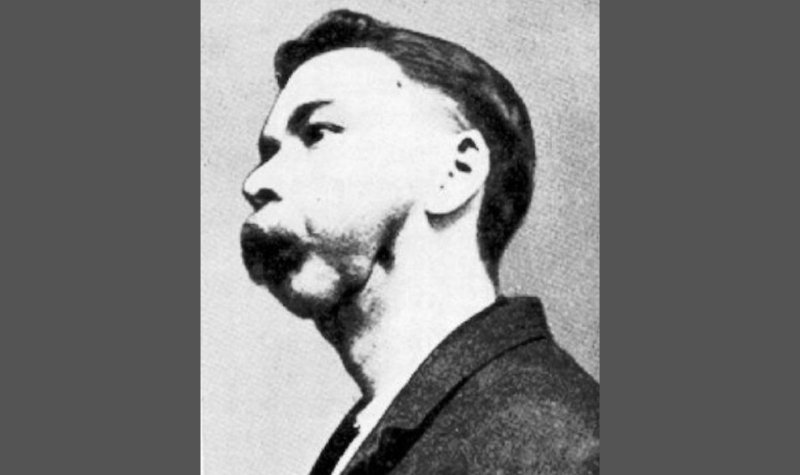 Atlet Ini Kehilangan Rahang Setelah Minum 1400 Lebih Botol Air Radioaktif 3 Lampiran Gambar