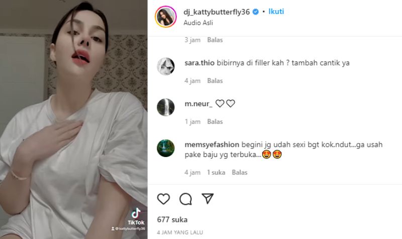 Tampak Lebih Cantik, Netizen Curiga DJ KatyButterfly Lakukan Filler Bibir 2 Lampiran Gambar