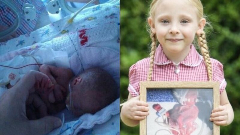 Bayi yang Lahir Seukuran Kantong Plastik Kecil Berhasil Bertahan dan Mulai Sekolah Dasar