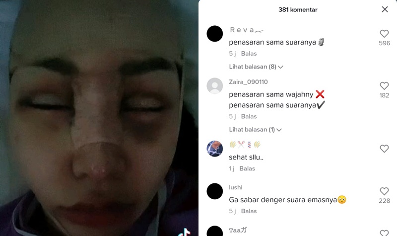 Lucinta Luna Ungkap Sisi Gelapnya yang Terlihat Seram dan Seperti Pria 2 Lampiran Gambar