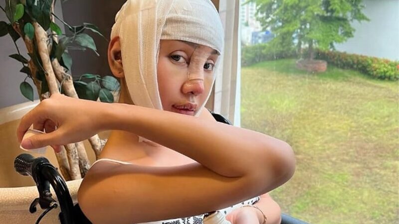 Lucinta Luna mengunggah video dirinya yang terlihat seram, wajahnya terlihat masih lebam usai operasi dan kepalanya masih diperban.