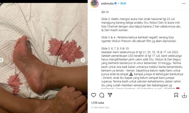 Innalilahi, Widi Mulia Keguguran Anak Ke-4: Belum Rezeki Kami 5 Lampiran Gambar
