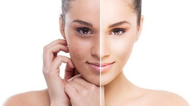 Menjadi glowing merupakan hal yang diinginkan banyak orang, terutama bagi wanita yang terlihat semakin cantik jika sudah glow up.