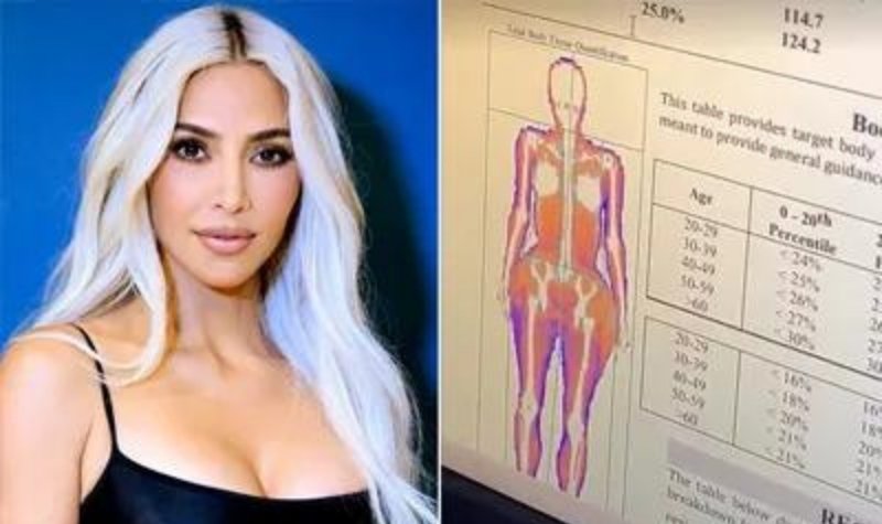 Kim Kardashian membagikan hasil rontgen tubuhnya, dia menyebutkan bahwa tulang dan jumlah lemaknya termasuk kategori sangat sehat.