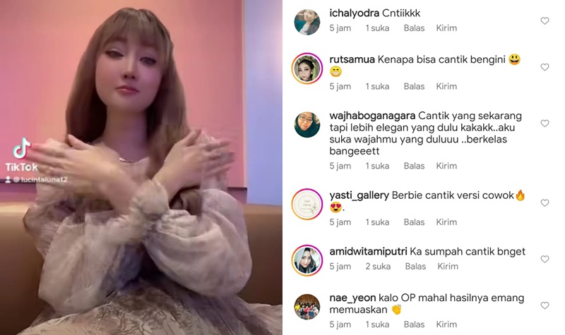Makin Cantik Usai Oplas, Lucinta Luna Disebut Barbie Hidup Versi Cowok 2 Lampiran Gambar