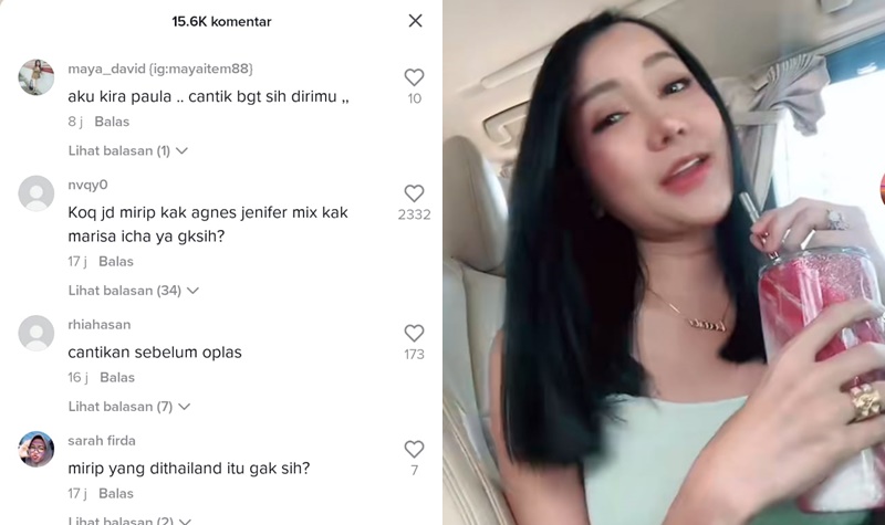 Sudah Makin Pulih, Wajah Hasil Oplas Lucinta Luna Bikin Kamu Bakal Susah Berkedip 2 Lampiran Gambar