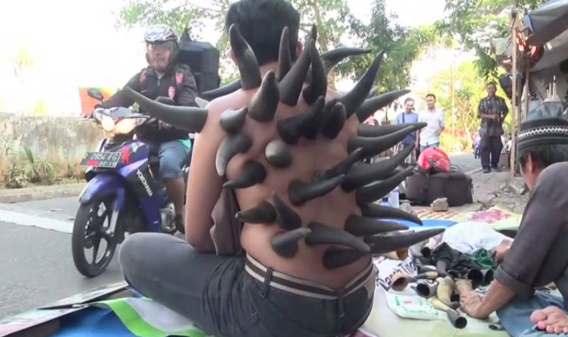 Unik, Bekam Tanduk Kerbau Curi Perhatian Lantaran Buat Pasien Seperti Karakter Bowser Super Mario