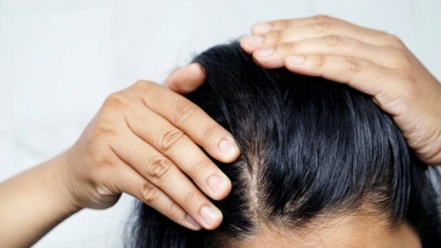 Cekricek.id - Keratin adalah protein penting yang diproduksi tubuh kita secara alami untuk membentuk kuku, kulit dan juga rambut. Tingkat keratin yang sehat dapat meningkatkan kekuatan dan penampilan ketiga hal tersebut. Terutama untuk rambut, ada sejumlah makanan yang bisa dikonsumsi untuk meningkatkan kadar keratin kita.