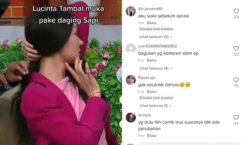 Demi Jadi Cantik, Lucinta Luna Rela Tambal Wajah dengan Daging Sapi 2 Lampiran Gambar
