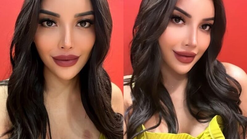 Millen Cyrus hebohkan warganet dengan sebuah bekas merah yang ada du bawah dadanya yang terlihat seperti sebuah bekas kecupan.