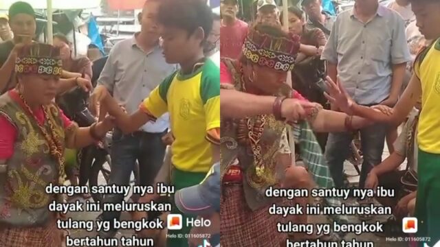 Seorang ibu-ibu viral di media sosial usai berhasil meluruskan tangan seorang laki-laki yang bengkok hanya dalam waktu hitungan detik.
