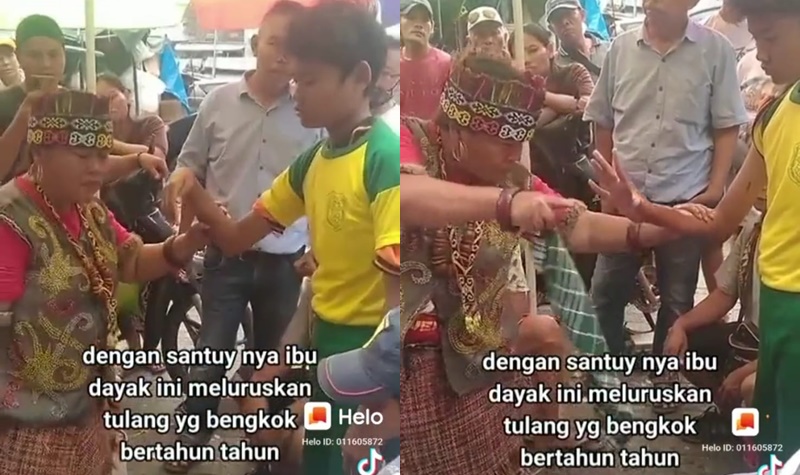 Seorang ibu-ibu viral di media sosial usai berhasil meluruskan tangan seorang laki-laki yang bengkok hanya dalam waktu hitungan detik.