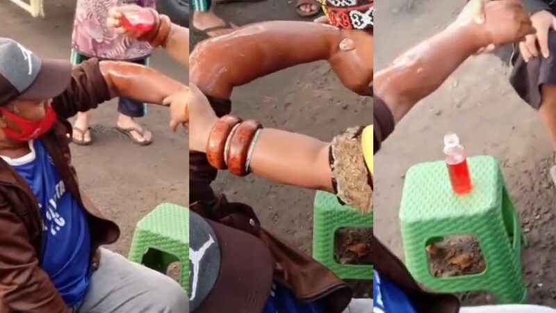 Cekricek.id - Belakangan ini banyak beredar video pengobatan patah tulang yang dilakukan oleh ibu Dayak. Ibu-ibu yang berasal dari Kalimantan Timur itu menyebut dalam sejumlah videonya bahwa dia bisa meluruskan kembali tulang yang bahkan sudah 10 tahun bengkok.