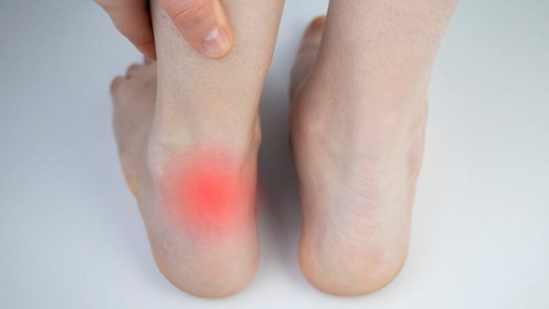 Cekricek.id - Sebenarnya ada beberapa alasan dan penjelasan mengapa kaki tidak berhenti berkedut. Simak penjelasan lengkapnya