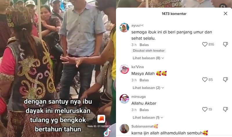 Menakjubkan, Wanita Ini Bisa Meluruskan Tangan yang Bengkok Bertahun-tahun Hanya dalam Hitungan Detik 2 Lampiran Gambar