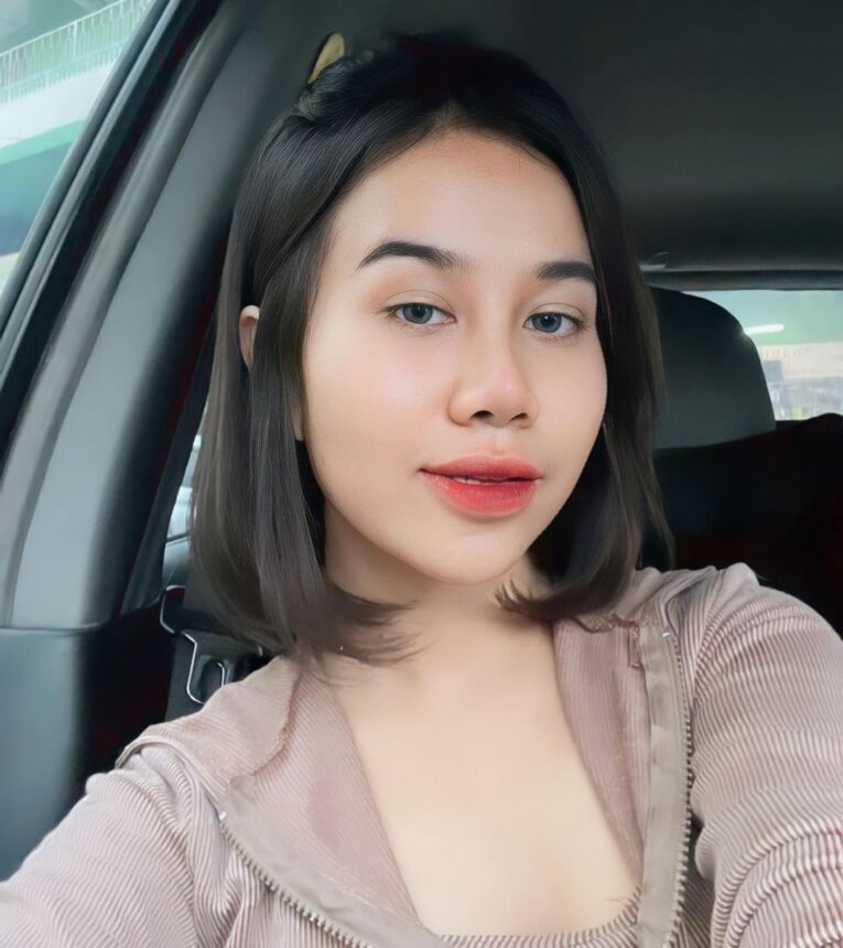 Udah Lepas Perban, Intip Hidung Baru Mayang Lucyana yang Disebut Mancung Natural 2 Udah Lepas Perban, Intip Hidung Baru Mayang Lucyana yang Disebut Mancung Natural