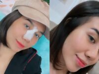 Cekricek.id - Mayang Lucyana yang sempat membuat gempar karena operasi plastik yang dijalaninya kini sudah melepas perban di hidungnya. Dia bahkan terlihat mengunggah konten video dengan penampakan hidung barunya yang mancung.