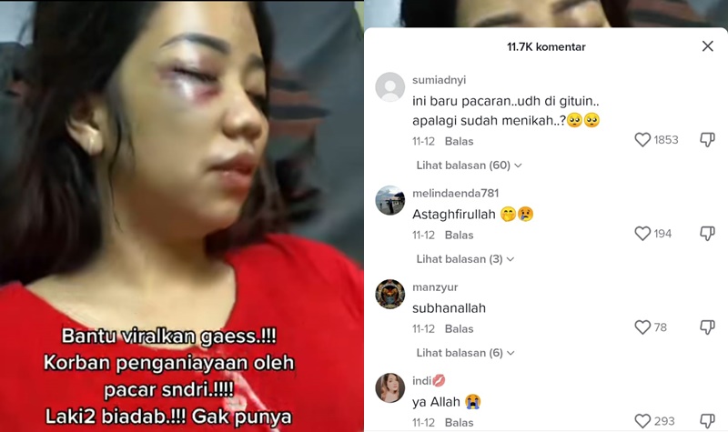 Viral, Wanita Diaaniaya Pacar Sendiri Sampai Babak Belur Dan Tak ...