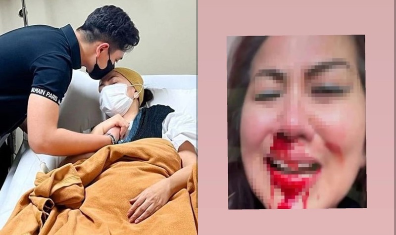 Belum Genap Setahun Menikah, Venna Melinda Laporkan Suami Atas Kasus KDRT, Mulut dan Hidung Sampai Berdarah 2 Lampiran Gambar