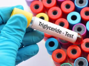 Cekricek.id - Kurangnya pengetahuan terkadang membuat seseorang sulit untuk membedakan antara trigliserida dengan kolestero