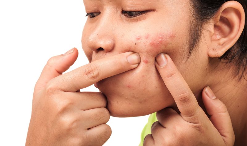 3 Rekomendasi Treatment Penghilang Flek Ala dr Richard Lee 2 Lampiran Gambar