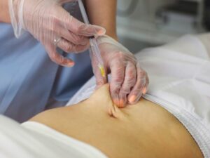 Cekricek.id, Kecantikan - Istilah suntik putih serta infus whitening umum digunakan oleh sejumlah orang yang ingin mendapatkan kulit putih instan.