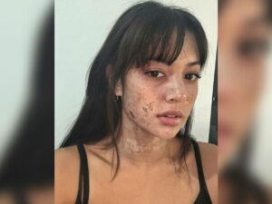 Cekricek.id, Berita Artis dan Berita Seleb - Artis serta pemeran cantik Aurelie Moeremans membagikan potretnya dengan wajah yang terlihat aneh.