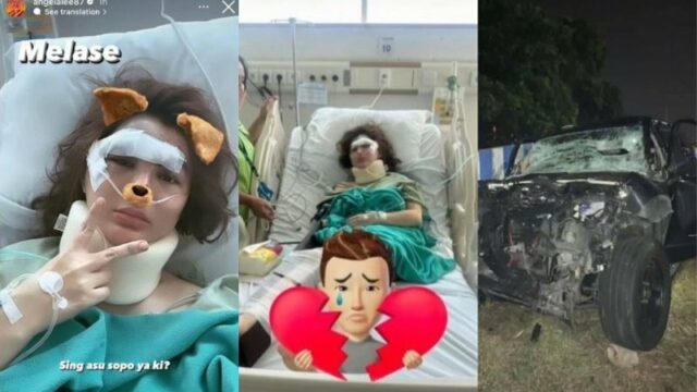 Cekricek.id, Berita Seleb dan Berita Artis – Penampakan wajah Angela Lee setelah belum lama ini mengalami kecelakaan beredar dan viral di internet. Selebgram berparas cantik itu membuat banyak orang merasa prihatin atas kejadian yang menimpanya itu. Apalagi, karena tragedi tersebut dia harus di rawat di rumah sakit dengan luka yang cukup serius.