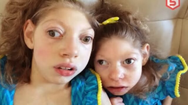 Cekricek.id, Berita Viral - Di berbagai penjuru bumi tentu ada sejumlah deretan bocah unik. Misalnya saja bocah gajah sampai dengan bocah penyu