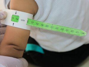 Angka Stunting di Tanah Datar Menurun, Secara Umum Sumatera Barat Meningkat