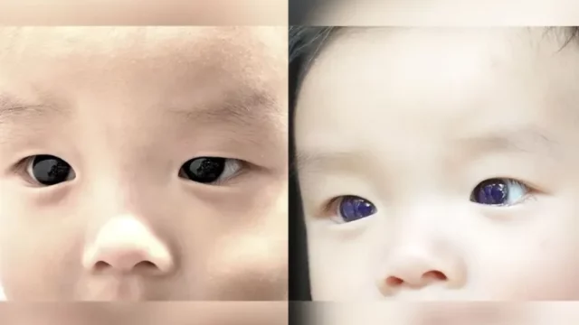 Misteri Perubahan Warna Mata Bayi Menjadi Biru Setelah Pengobatan Antivirus COVID-19