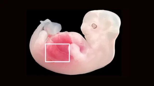 Ilmuwan Tiongkok Berhasil Kembangkan Ginjal Manusia dalam Embrio Babi