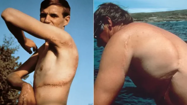 Kisah Ajaib Pria Australia yang Selamat dari Serangan Hiu.