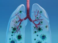 Cekricek.id - Penelitian Ungkap COVID-19 Bertahan di Paru-Paru hingga 18 Bulan