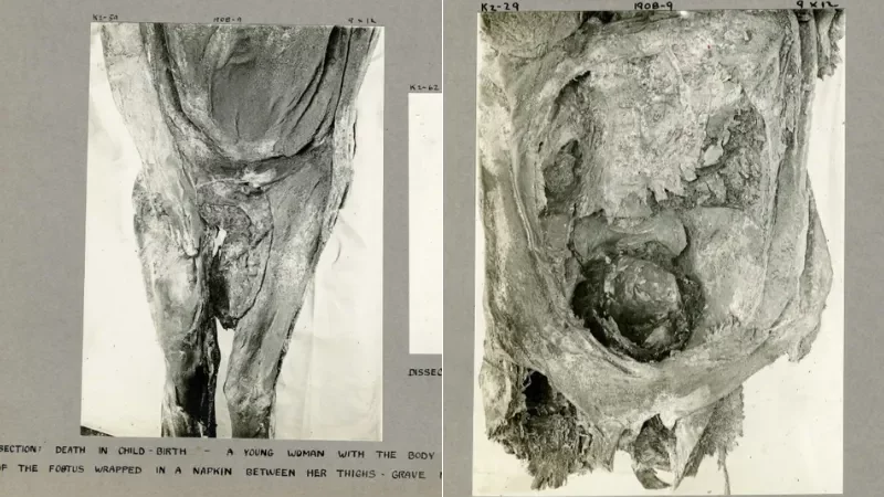 Cekricek.id - Misteri Penemuan Mumi Perempuan Mesir Kuno Tanpa Kepala Bersama 2 Bayi Kembar