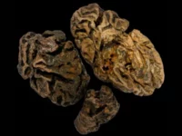 Rahasia di Balik Otak Manusia Berusia 12.000 Tahun yang Masih Utuh