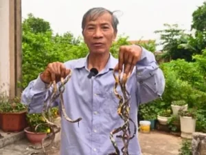 Pria dengan Kuku Sepanjang 1 Meter, Bergantung pada Istri untuk Aktivitas Sehari-hari