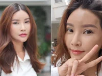 Sarwendah Ungkap Perubahan Wajah Pasca Operasi Plastik: Masih Dalam Proses Pemulihan