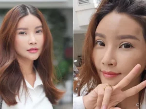 Sarwendah Ungkap Perubahan Wajah Pasca Operasi Plastik: Masih Dalam Proses Pemulihan