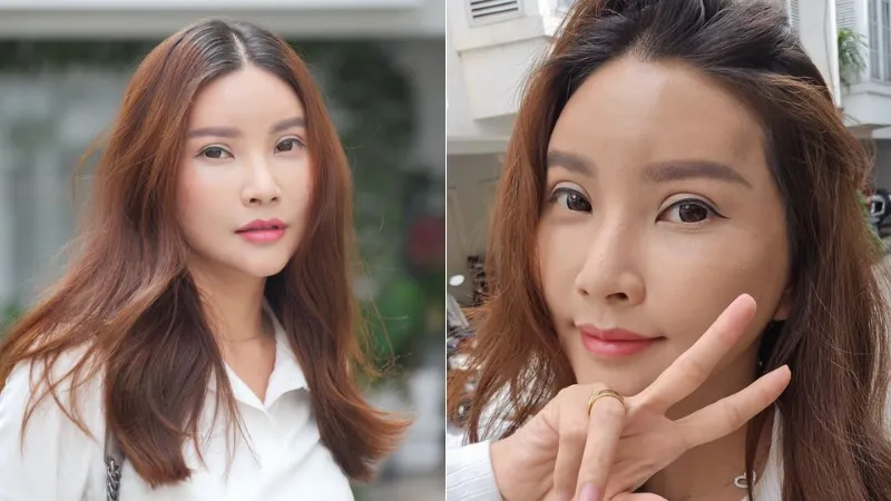 Sarwendah Ungkap Perubahan Wajah Pasca Operasi Plastik: Masih Dalam Proses Pemulihan